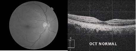 Como Funciona o Olho - Clínica de Oftamologia Macruz - Cirugias da